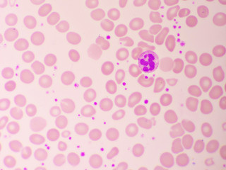 Neutrophil cell in blood smear, analyze by microscope, 1000x