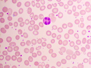 Neutrophil cell in blood smear, analyze by microscope, 1000x