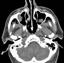 Head tomography. Head in section. Medicine.