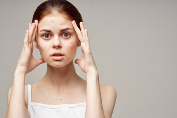 Fototapeta premium young woman with headache