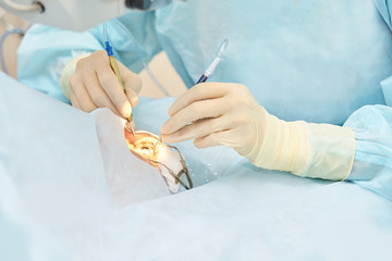 Ophthalmology laser microscope operation. Doctor in clinic. Patient eye treatment. Myopia and...