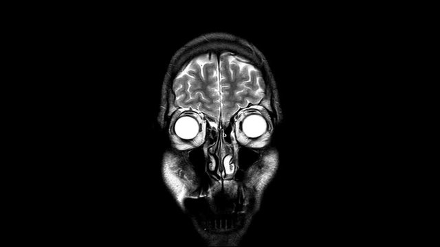 Human Brain MRI Scan from Front,  X-ray  - XRay Magnetic Resonance imaging of a brain, Ultra HD 4k, Time Lapse