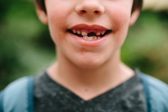 gap tooth smile of little boy