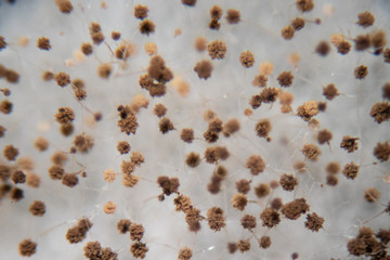 Rhizopus (bread mold) is a genus of common saprophytic fungi,Rhizopus (bread mold) under the microscope.