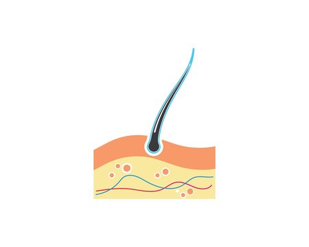 hair follicle diagram, skin layers, medical clip art preview
