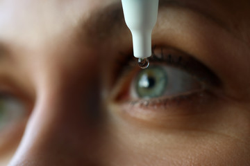 Female putting liquid drops in her eye solving vision problem