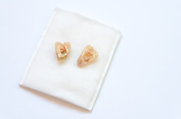 Old broken milk tooth from kid mouth after visiting dentist at clinic, bad decayed teeth broke in half
