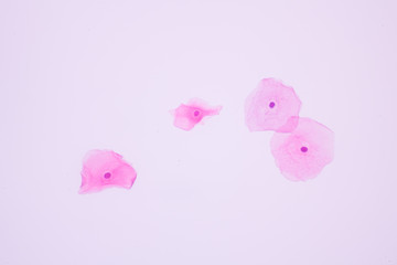 View in microscopic of normal human cervix cells.Squamous epithelium cells.Superficial epithelial...
