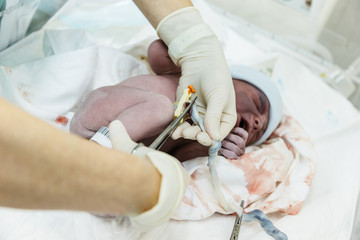 bebe recien nacido con enfermera cortando cordón umbilical, en el hospital