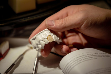 Hand holding a dental plaster cast with medical books in the background