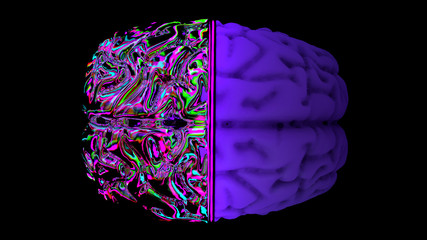 MRI scan of the brain in the color purple
