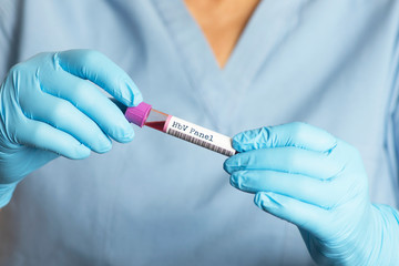  HBV-Hepatitis B Virus blood test tube.  The HBV test can help determine the the hepatits b infection status in patients  before beginning HCV treatment.