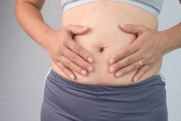 Close up of Woman touching belly skin with stretch marks and loose skin after giving birth. Health...