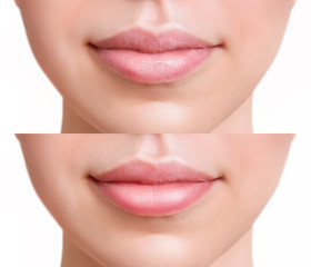 Sensual female lips before and after moistening.