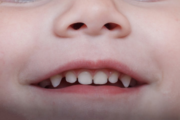 Obraz premium Baby tooth, close-up of the tooth that falls macro shot