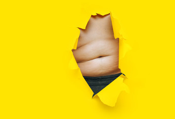 Male fat, flabby stomach in a torn aperture of yellow paper. The concept of beer belly, gluttony and cellulite. Copy space. - obrazy, fototapety, plakaty