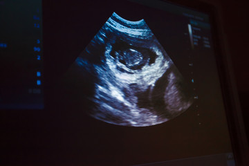 Snapshot of the dog's pregnancy on the monitor screen. Veterinary Concept. Veterinarian is doing ultrasound. View the puppy in the dog.