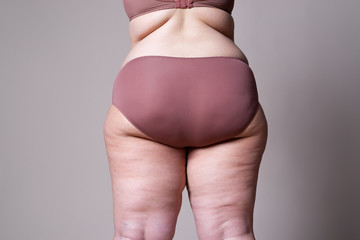 Overweight woman with fat legs and buttocks, obesity female body