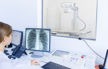Unrecognizable woman doctor analyzing X-ray snapshot of chest