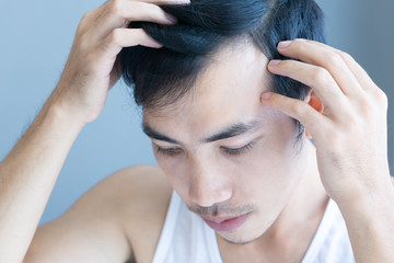 Naklejka premium Young man serious hair loss problem for health care medical and shampoo product concept, selective focus