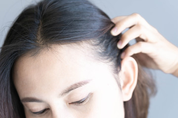Naklejka premium Woman serious hair loss problem for health care shampoo and beauty product concept, selective focus