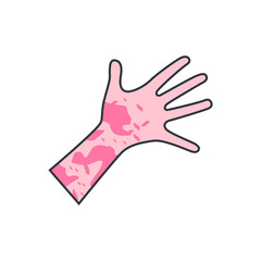 Skin rash, insect bites allergy reaction. irritation on hand. vector illustration