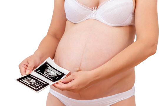 Pregnant woman in underwear holding sonogram