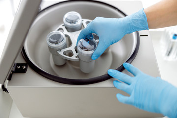 Top view if preparation process for plasmalyting