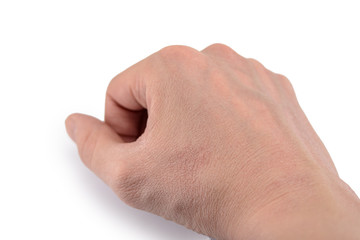 dry skin close-up on a light background, Allergy, skin peeling, moisturizing