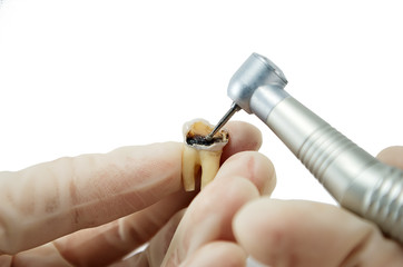 dental handpiece drills a tooth isolated on a white background, the treatment of carious tooth, the training of dentists