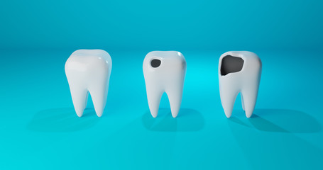 Image of three different teeth: a healthy tooth, teeth with a hole and caries. Concept for dental clinic, medicine, treatment of children's teeth design. 3d render illustration.