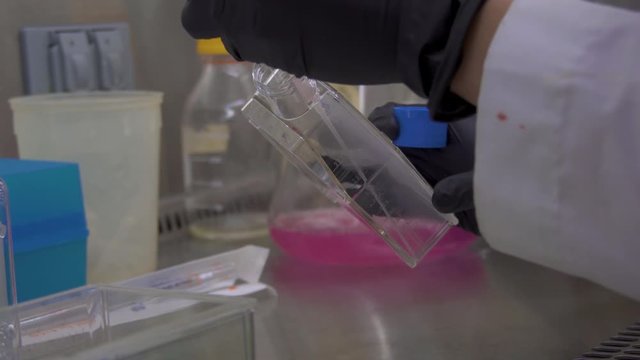 removing spent media from a tissue cutlure flask