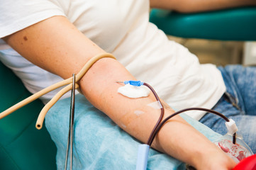 Blood transfusion in the ICU