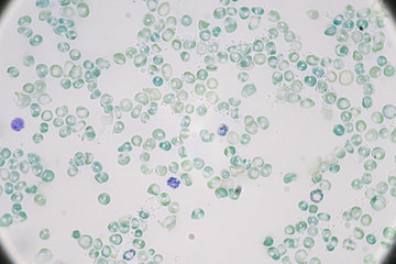 Red blood cells (Polychromasia)