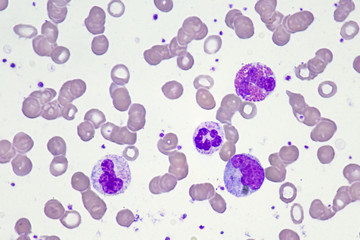 White blood cells (Neutrophil , Monocyte and Eosinophil)