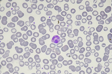 Neutorphils (White blood cells , Myeloid)