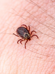 Encephalitis Tick Insect Crawling on Skin. Encephalitis Virus or Lyme Borreliosis Disease Infectious Dermacentor Tick Arachnid Parasite Macro.