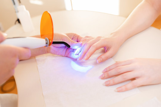 Medicine, nail Polish and prosthetic nail. In the nail salon, a procedure for prosthetics of the nail on the hand is carried out. In the hands of the master ultraviolet lamp. Close up