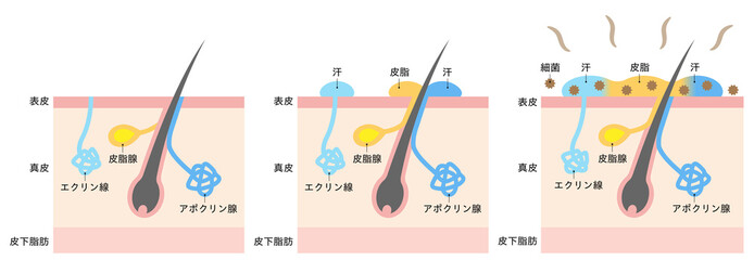 体臭の原因と汗腺　肌の断面図