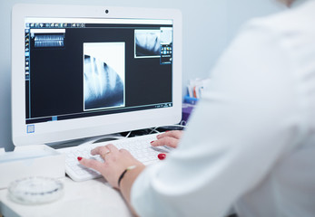 A female medical doctor looking at x-rays and using laptop in a hospital