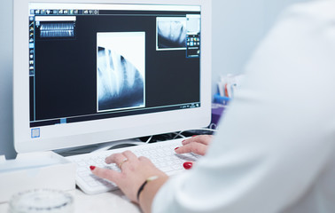 A female medical doctor looking at x-rays and using laptop in a hospital