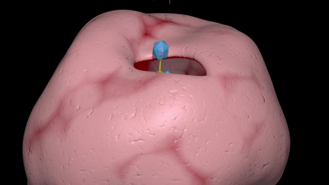Phage Therapy Many Viruses Exiting Bacteria , Cell.  Bacteriophage leaving infected cell , bacterium. Lytic cycle , cell bursts open , lysis releasing copies of new bacteriophages, 3D Animation