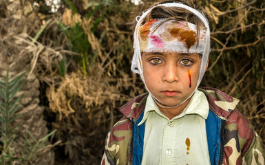 a cute injured child with sad expression and having bleeding bandage on his head