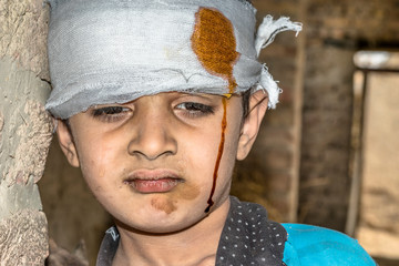 a young lonely missing injured child is crying cause of serious injuries in a war and having...