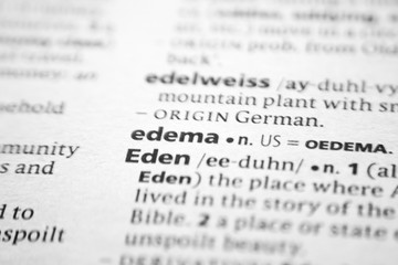 Word or phrase Edema in a dictionary.