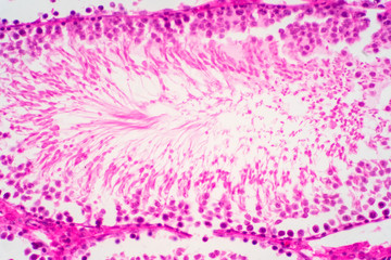 Fototapeta na wymiar Human sperm in the testis morphology under microscope.