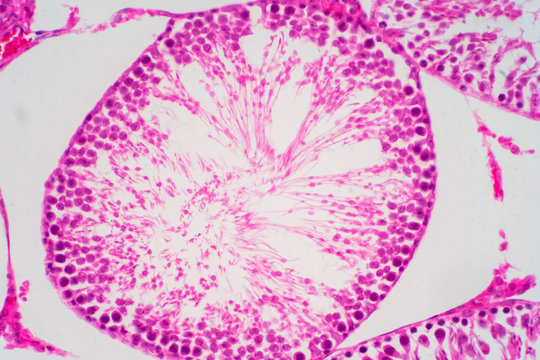 Human sperm in the testis morphology under microscope.