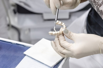 the dentist applies the solution to an artificial temporary prosthesis in the dentist office, a close-up of the hands with the prosthesis