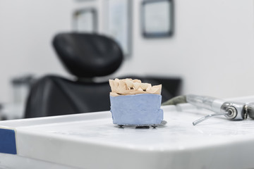 Dental prosthetics on implants, artificial jaw with dentures on the table in the dental office