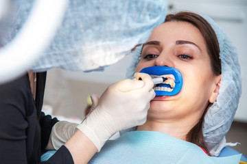 Preparing the oral cavity for whitening with an ultraviolet lamp. Close-up